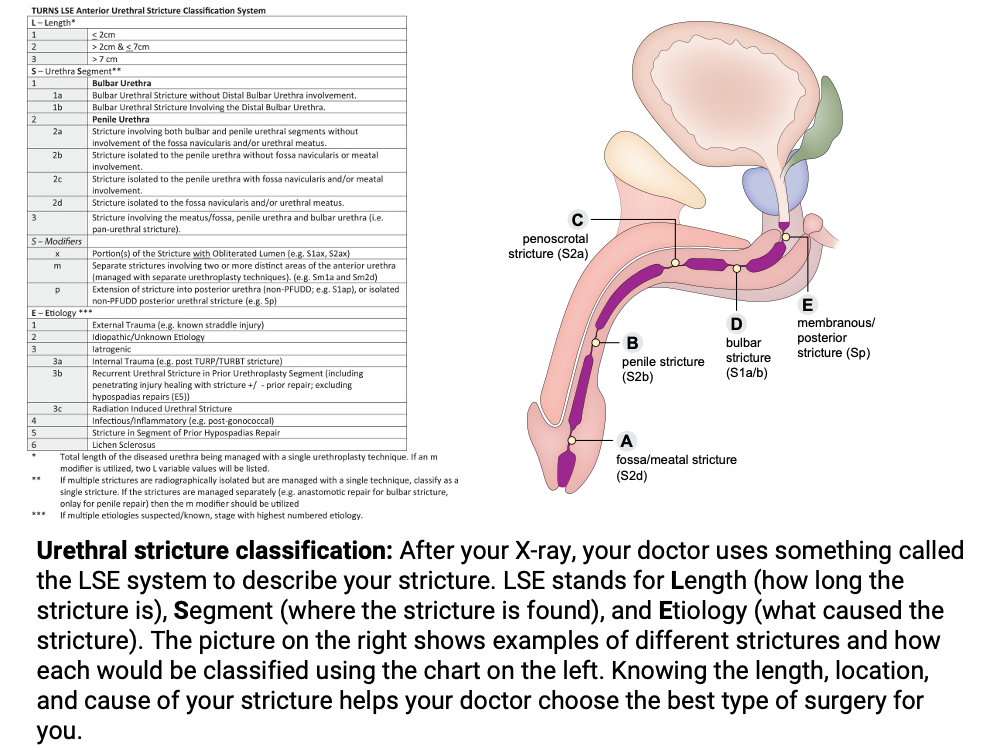 Urethral stricture classification