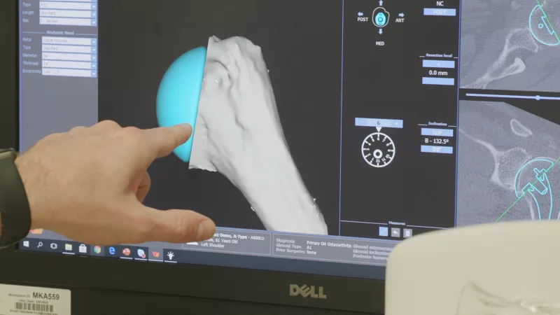 UI Health Care provider points at a shoulder joint on a computer