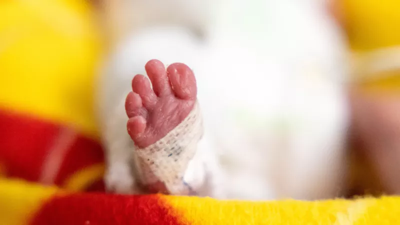 Multidisciplinary Care of Extremely Preterm Infants