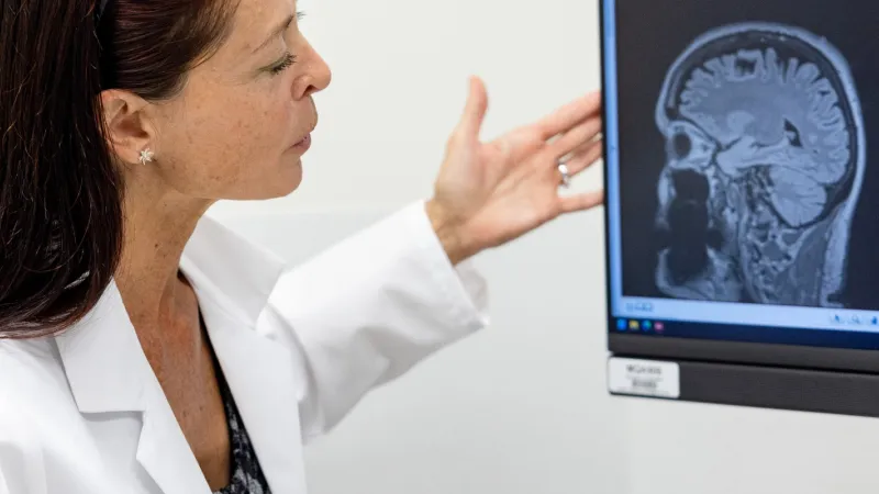 Doctor with brain scan photo