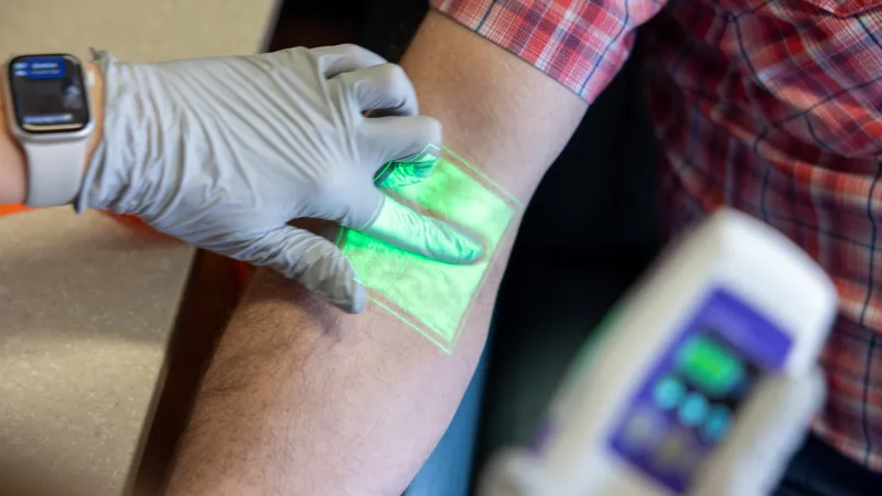 Vein access in Holden Comprehensive Cancer Center on the UI Health Care university campus on Monday, May 5, 2025.