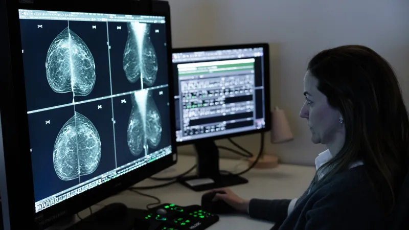 Bruna Thompson, MD, PhD in the breast imaging center