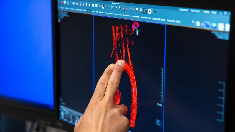 Cardiac Imaging