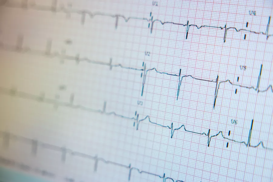 EKG with simulated patient in UI Heart and Vascular Center