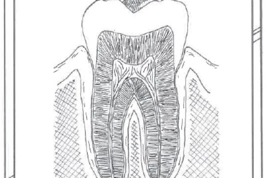Chisler Valentine art