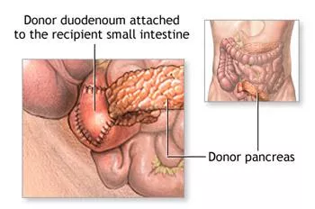 Pancreas Detail