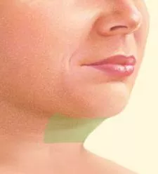Liposuction under chin selection