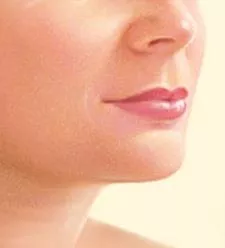 Liposuction under chin drawing