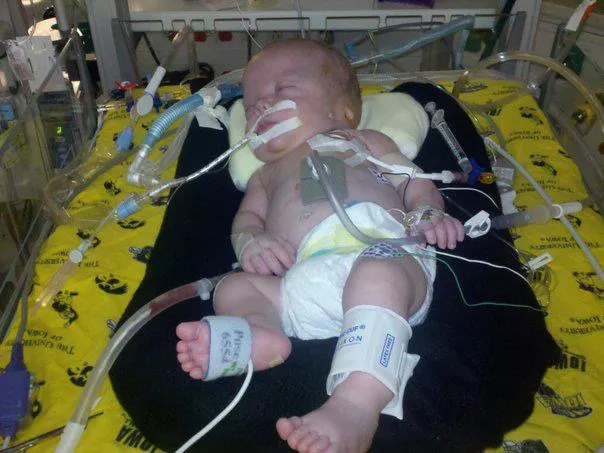 Bentley Erickson as an infant in hospital