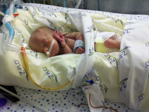 Bentley Erickson as an infant in hospital