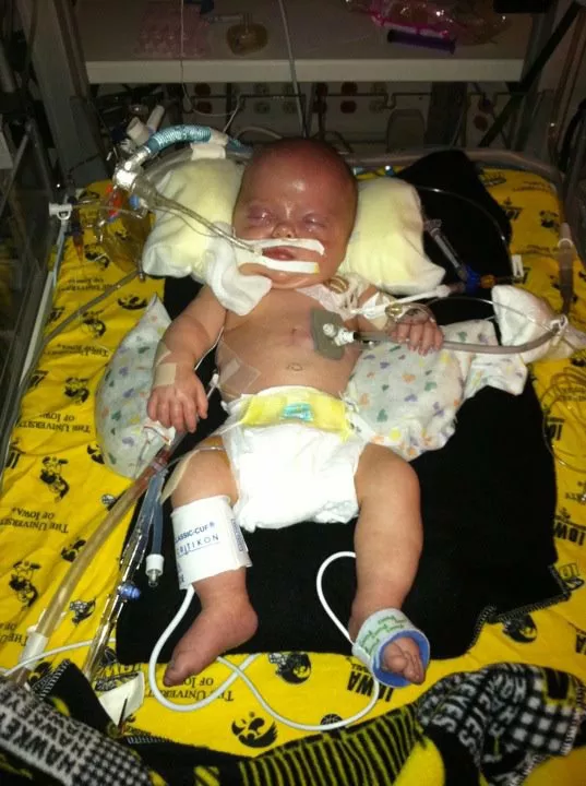 Bentley Erickson as an infant in hospital