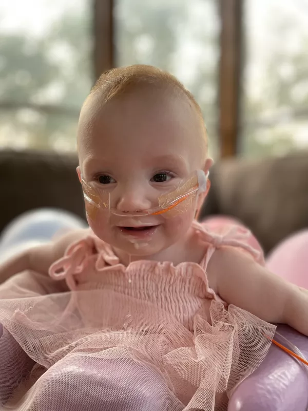 Tiniest surviving baby in U.S. celebrates her first birthday | Stead ...