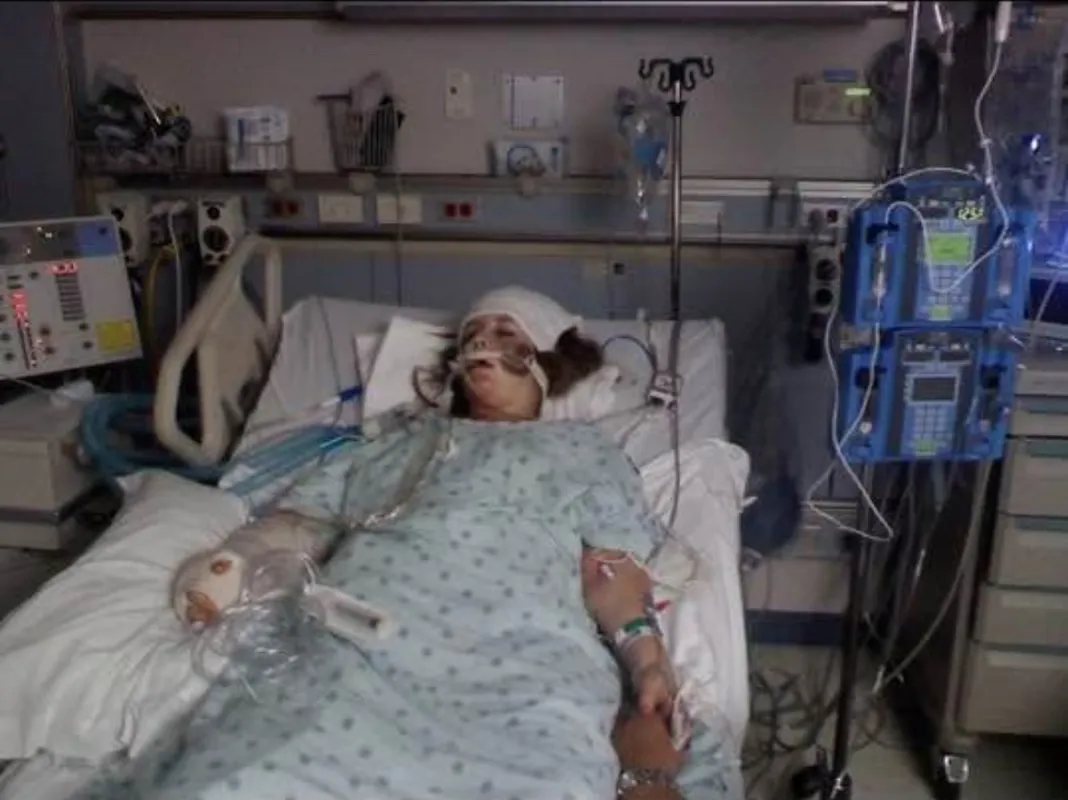 A car accident in 2009 left Caitlin Efstathiou with numerous injuries including a broken back, broken ribs, a lacerated liver, a broken leg, fractures in her hip socket, punctured lungs, a ruptured spleen, and an arm with severe abrasions.