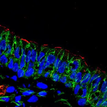 CFTR protein (red) is located at the surface of airway cells.