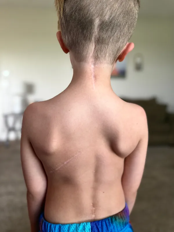 Kid Captain Luke Johnston's back