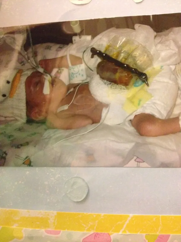 Kid Captain Lily Sebastian as a baby in the NICU