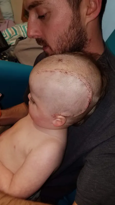 Kid captain Ray Walker showing his surgery incision marks on his head