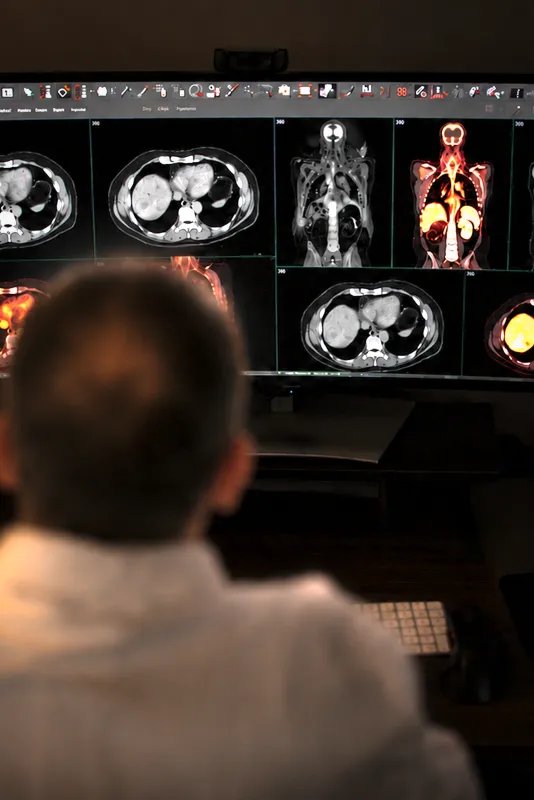 Dr. Yusuf Menda in the Nuclear Medicine clinic. Menda is a professor in the UI Department of Radiology and its Division of Nuclear Medicine working on clinical trials of theranostics, which allows physicians to see and target specific receptors on cancerous cells, minimizing the impact on surrounding healthy tissue.