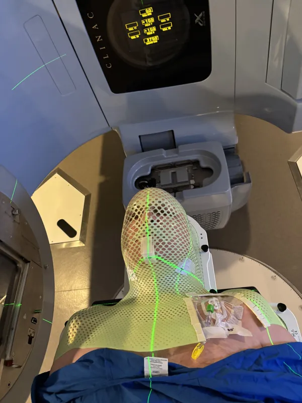 Jeff Yets receiving radiation treatment.