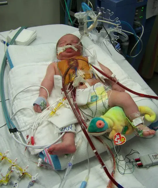 Kid Captain Beau Harvey as a baby in the hospital attached to tubes