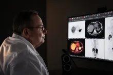 Dr. Yusuf Menda in the Nuclear Medicine clinic. Menda is a professor in the UI Department of Radiology and its Division of Nuclear Medicine working on clinical trials of theranostics, which allows physicians to see and target specific receptors on cancerous cells, minimizing the impact on surrounding healthy tissue.