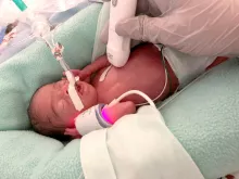 27 week old newborn receiving echocardiogram