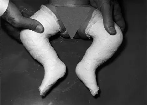 On the cure of club-foot without cutting tendons : and on certain