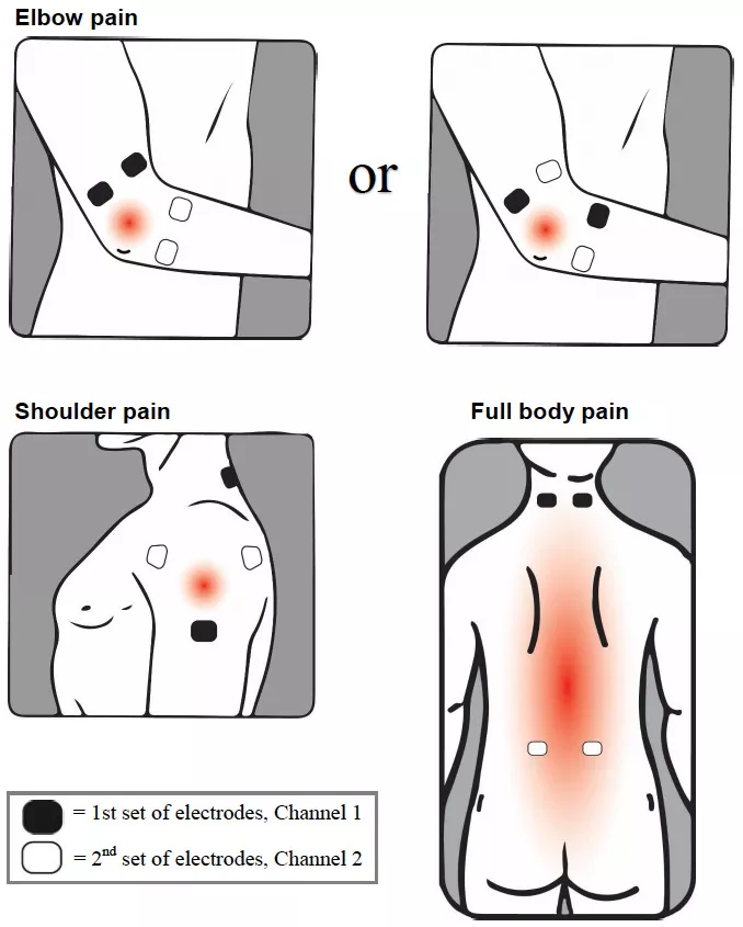 illustration of sensor placement on elbow and shoulder