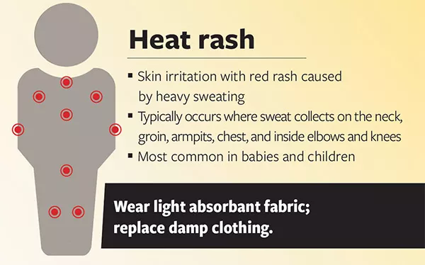 Heat rash illustration