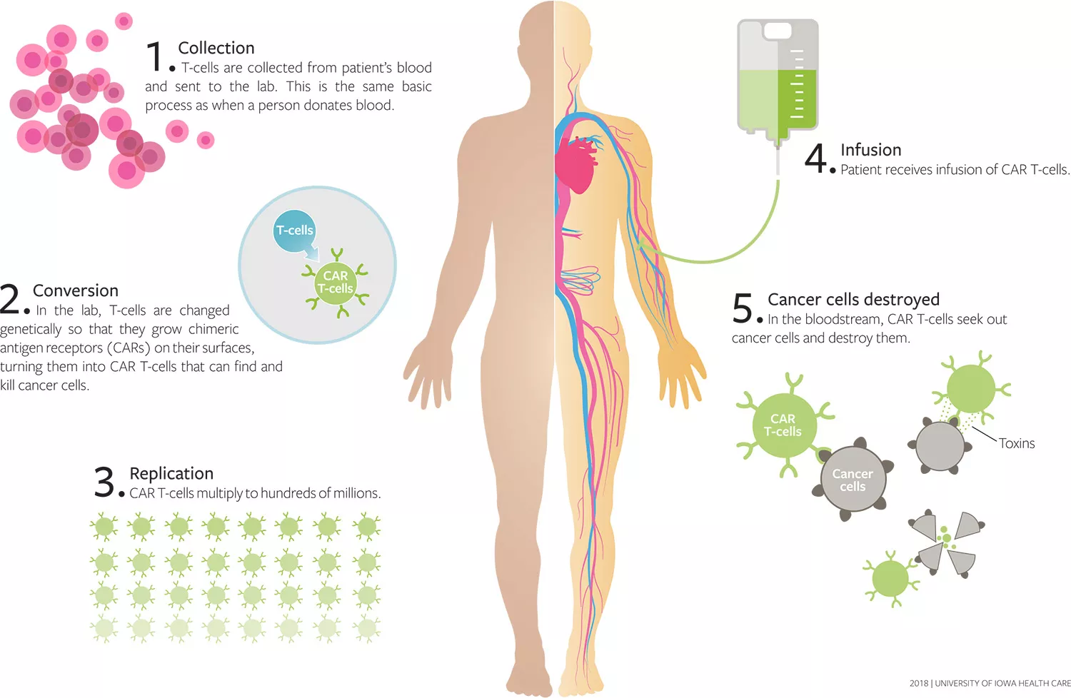 How do you decide?' Cancer patients die waiting for CAR-T therapy