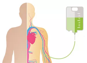 Illustration showing infusion point car-t cell therapy