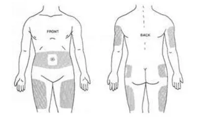 injection site illustration