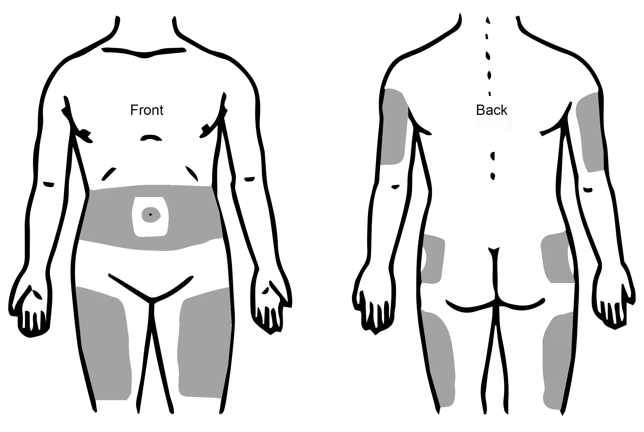 Injecting Insulin University Of Iowa Health Care   Insulin Locations .webp