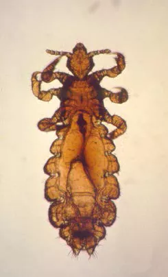 Detail of a louse