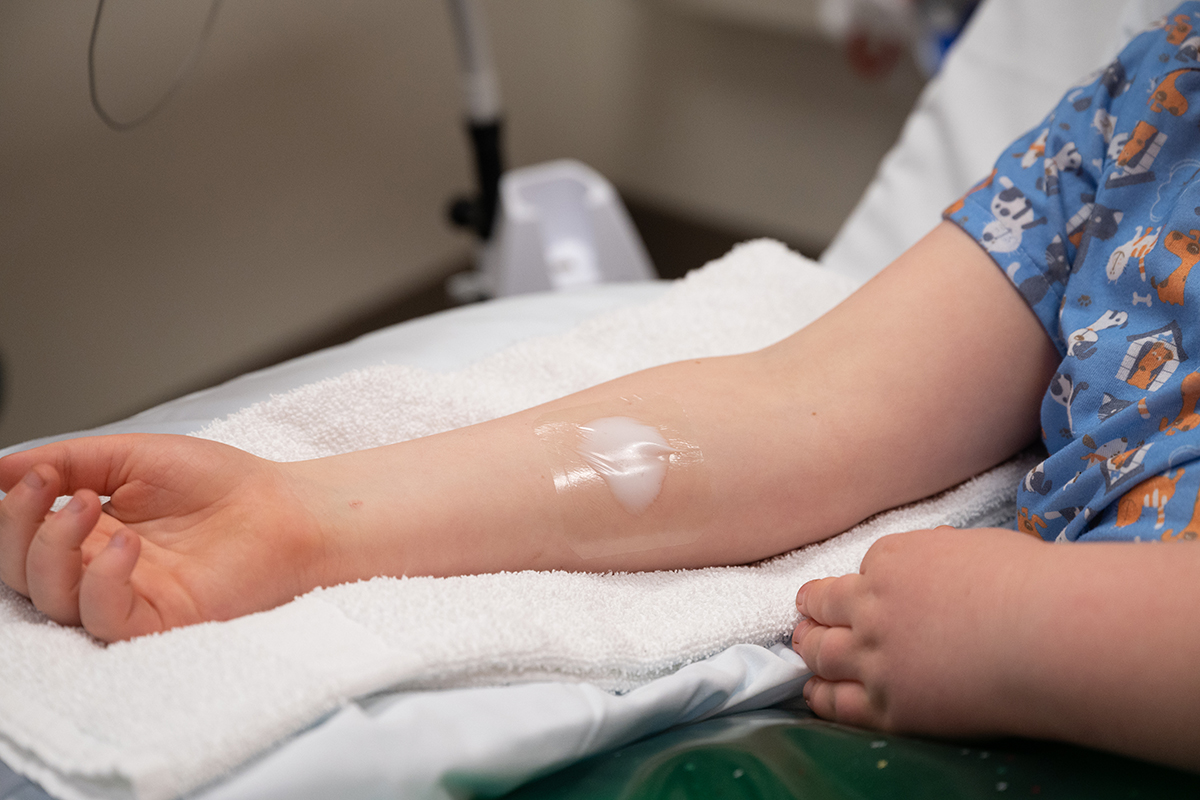 A child with numbing cream on their arm